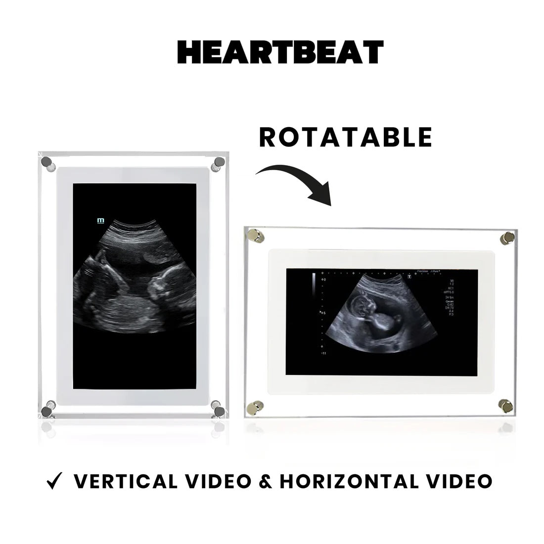 HEARTBEAT™ Digital Video Frame