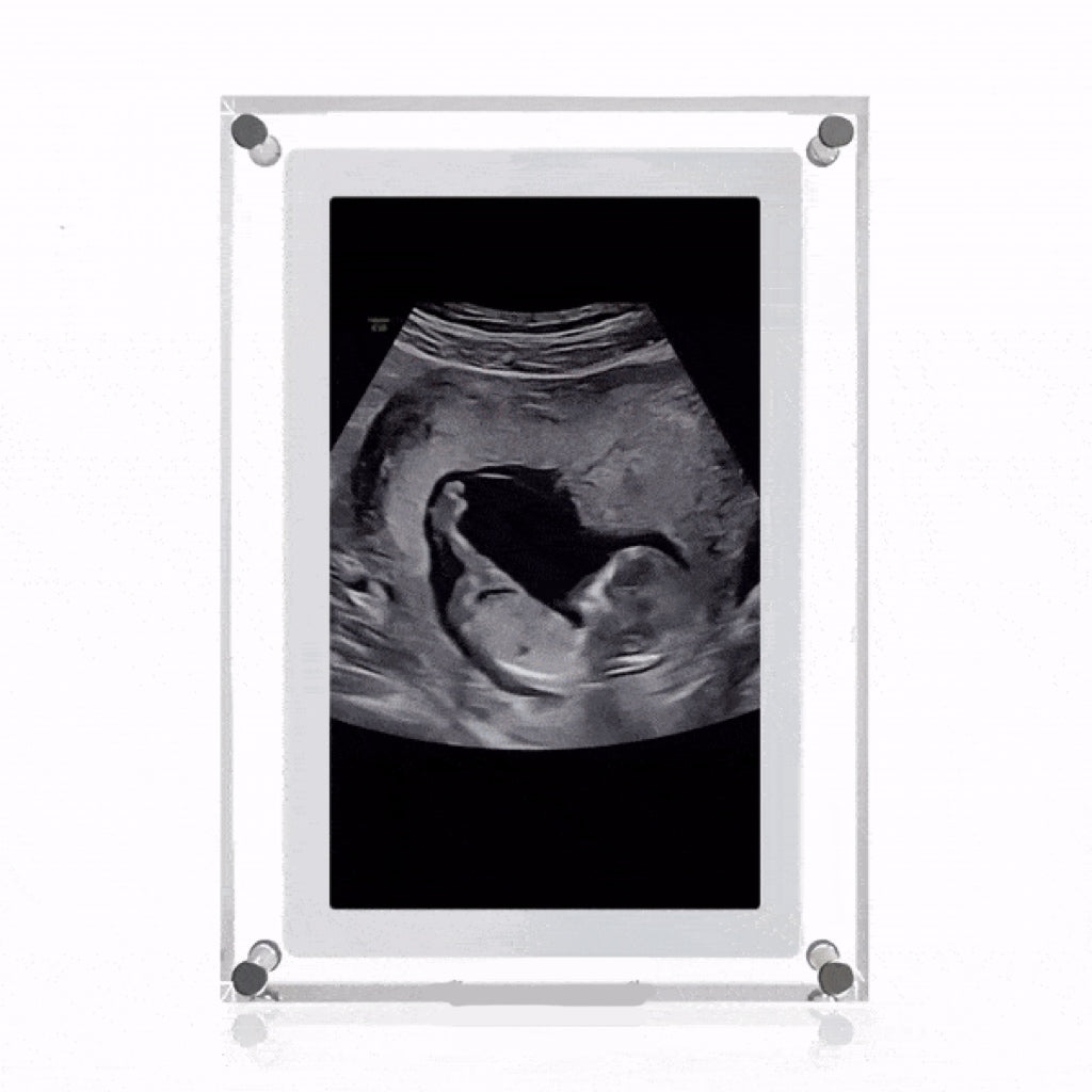 HEARTBEAT™ Digital Video Frame