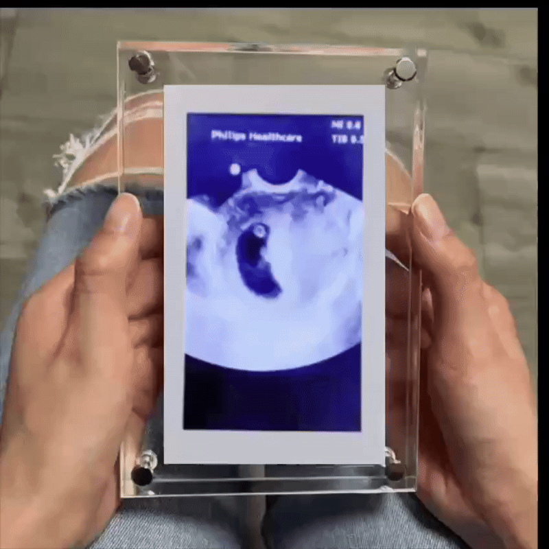HEARTBEAT™ Digital Video Frame